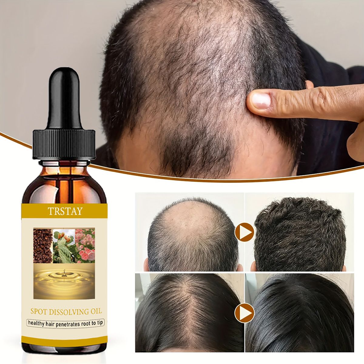 Beard Oil Growth - 50ML huile de croissance de barbe