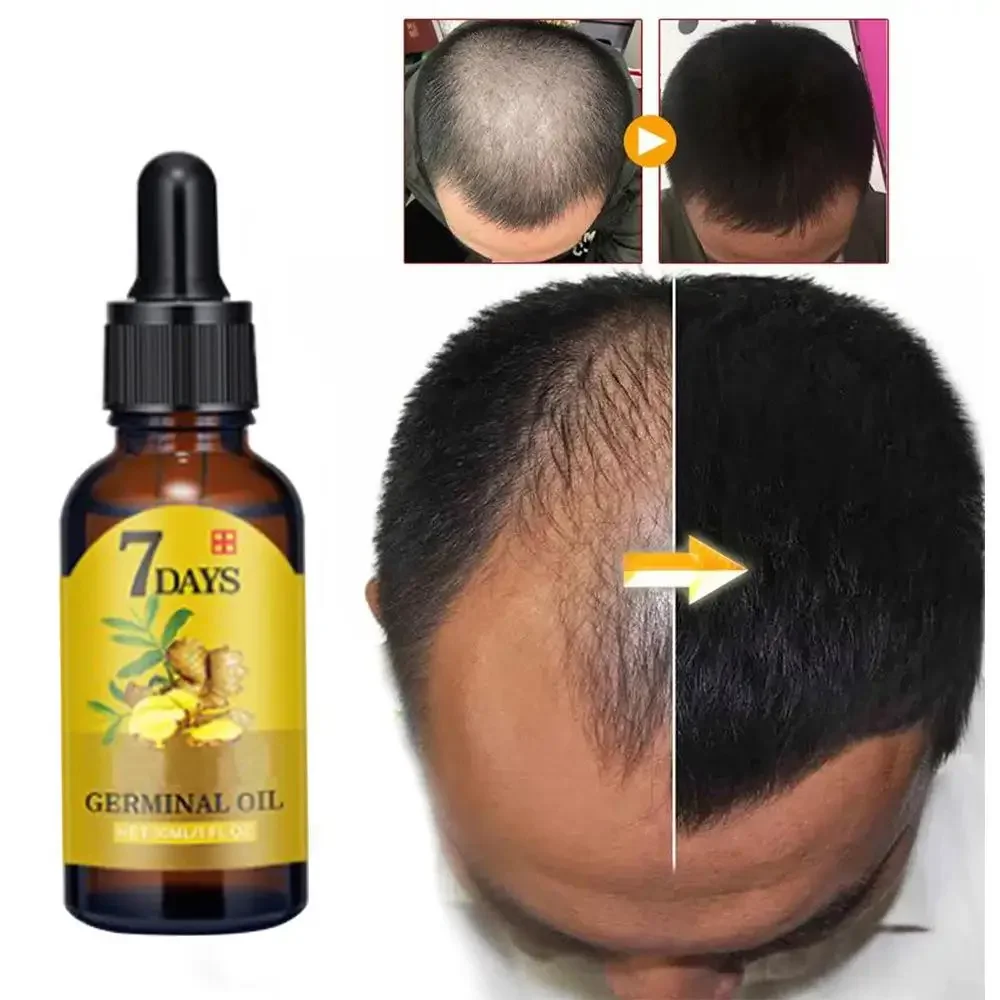 Beard Oil Growth - Huile essentielle de gingembre pour la