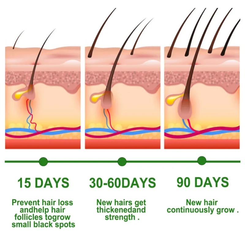 Sérum de croissance des cheveu - Beard Oil Growth avis et prix