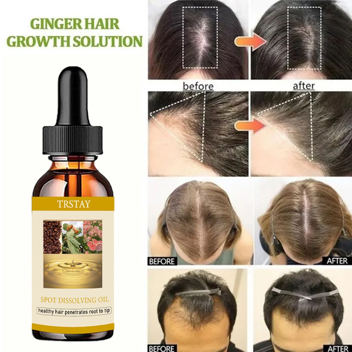 50ML huile de croissance de ba - Beard Oil Growth avis et prix